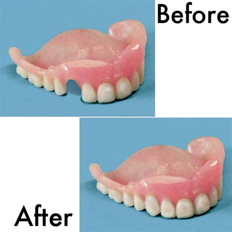 partial plate denture repair kit